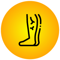 Varicose Vein Surgery Icon - KM NU Hospitals