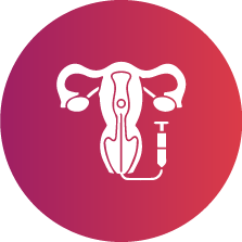 Embryo Transfer into the Uterus Icon - KM NU Hospitals