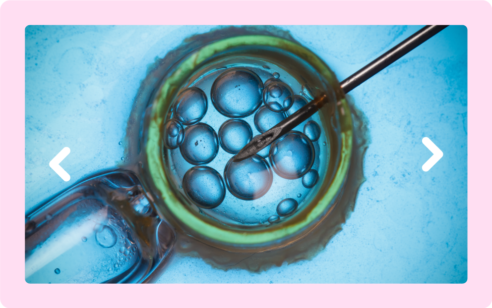 Best IVF Treatment in Ambur - KM NU Hospitals