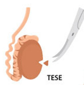 Urological Condition